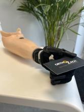 Comment réaliser une prothèse de membre supérieur myoélectrique ? L'explication de votre prothésiste Ortho Zach à Mons.