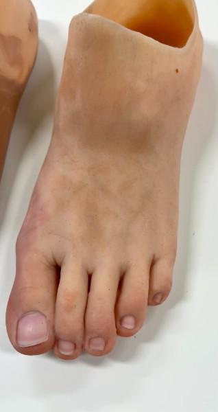 Une prothèse esthétique et fonctionnelle en silicone sur-mesure hyper réaliste!