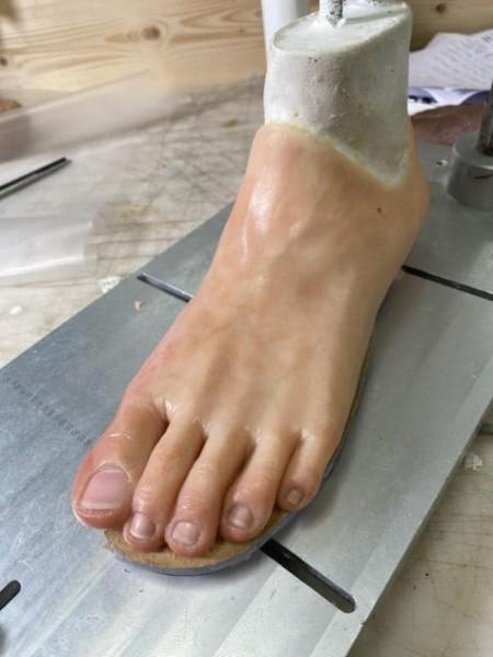 Prothèse pied sur-mesure à Mons